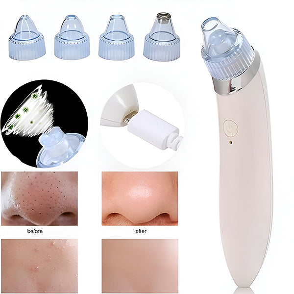 Dual-Action Pore Vacuum & Microdermabrasion Tool