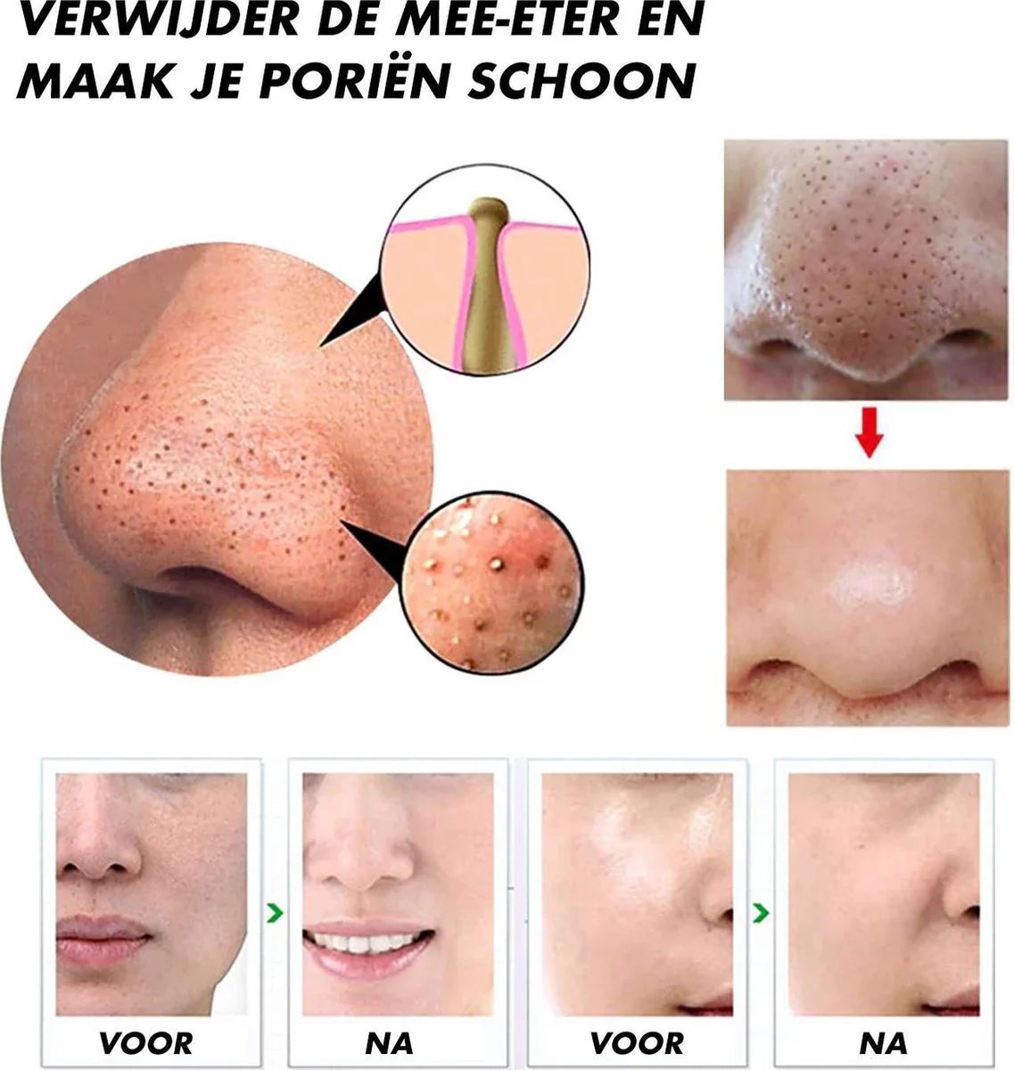 Rechargeable Electric Blackhead Remover – Pore Vacuum Cleaner for Smooth Skin