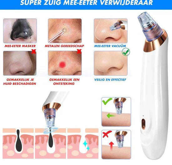 Rechargeable Electric Blackhead Remover – Pore Vacuum Cleaner for Smooth Skin
