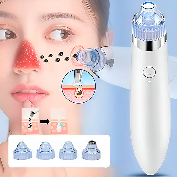 Dual-Action Pore Vacuum & Microdermabrasion Tool
