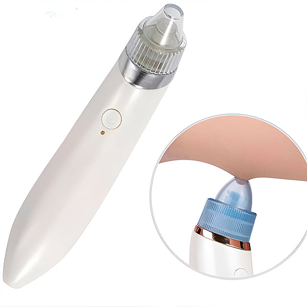Dual-Action Pore Vacuum & Microdermabrasion Tool