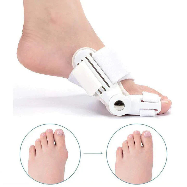 Bunion Corrector Splint (1 Pair)