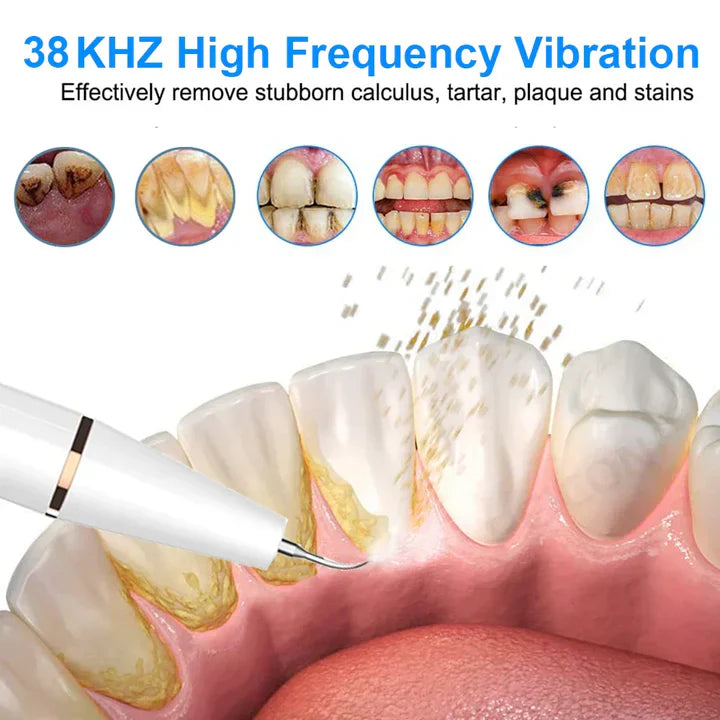 Electric Sonic Plaque Remover | SmileCare Pro