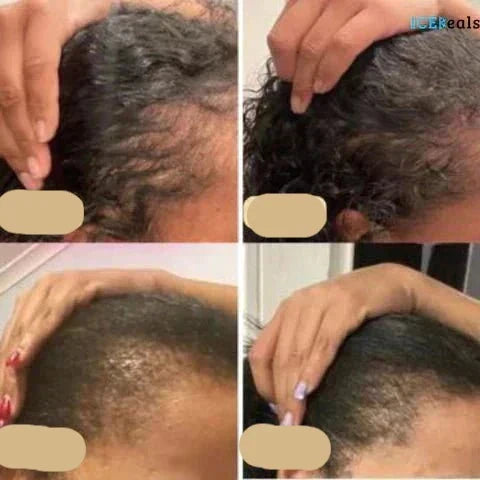 Plant-Based Hair Growth Elixir | Nourish & Strengthen Naturally