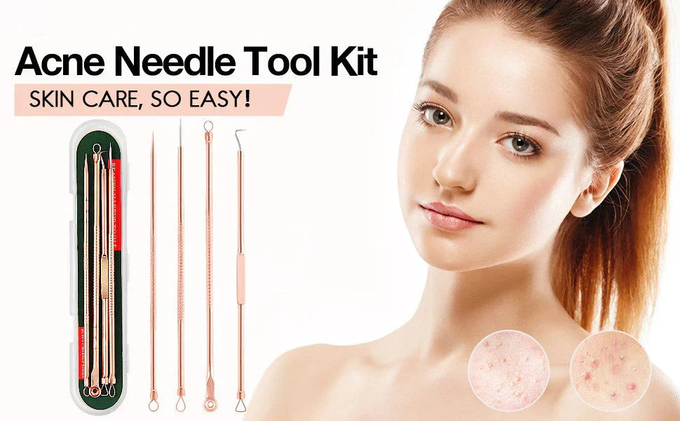 Professional Pimple & Blackhead Extractor Kit