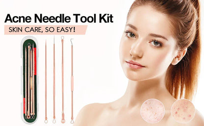 Professional Pimple & Blackhead Extractor Kit