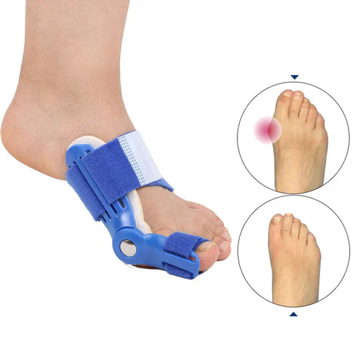 Bunion Corrector Splint (1 Pair)