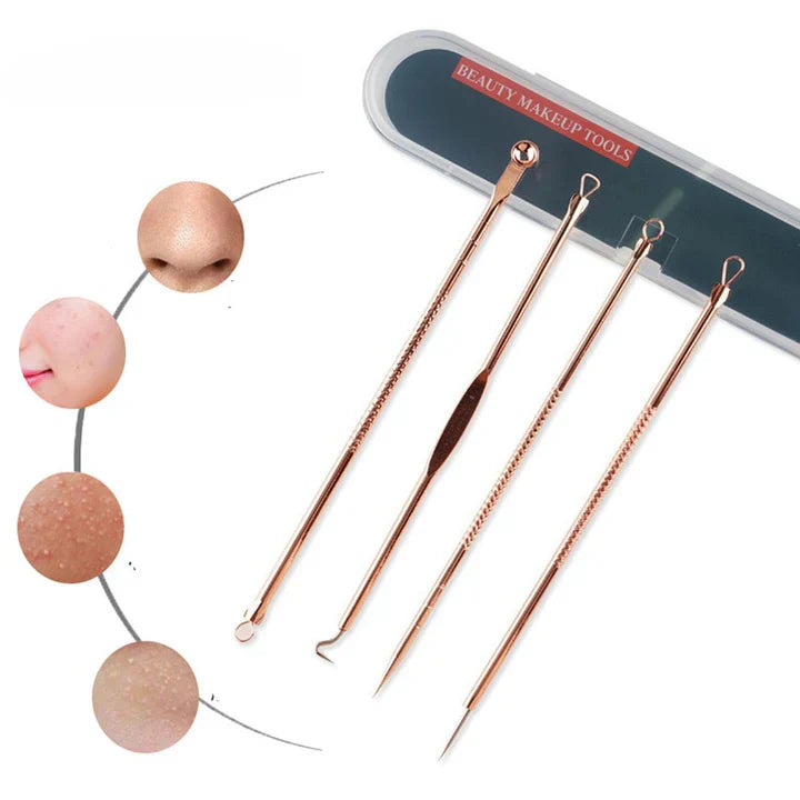 Professional Pimple & Blackhead Extractor Kit