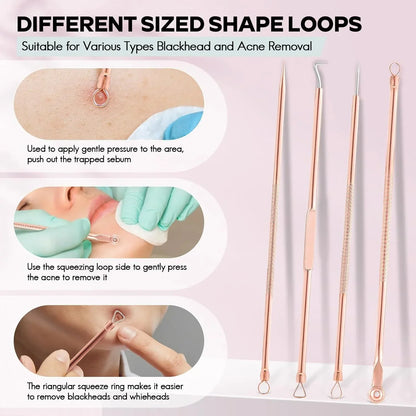 Professional Pimple & Blackhead Extractor Kit