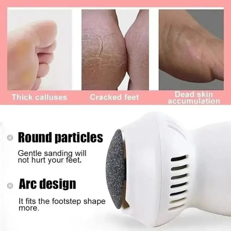 Electric Foot Callus Remover