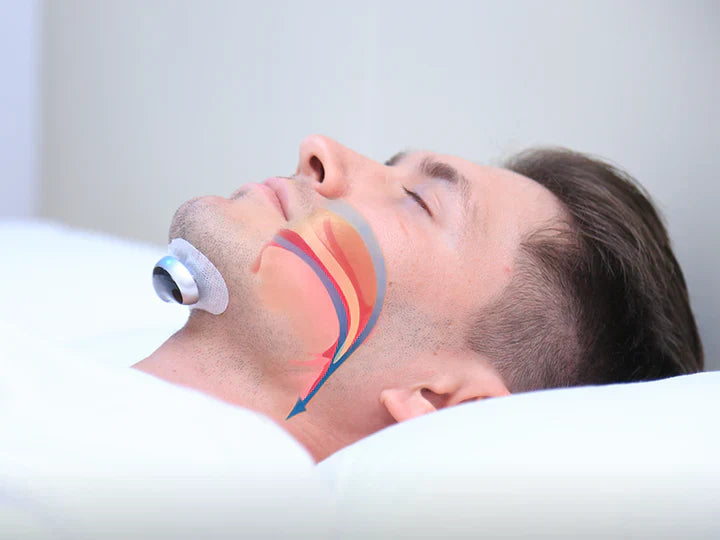 Smart Anti-Snoring Patch