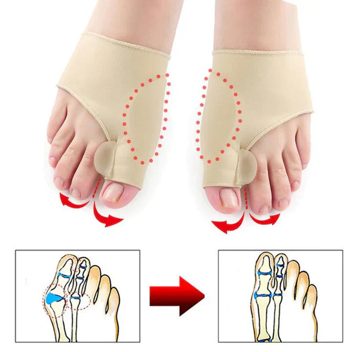 Hallux Valgus Foot Protection Sleeve (1 Pair)