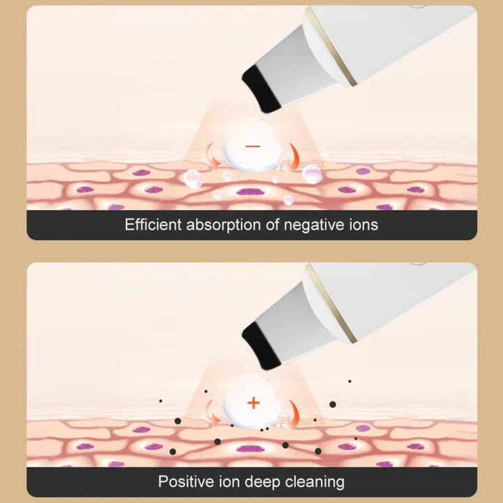 Ultrasonic Facial Skin Scrubber