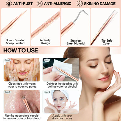 Professional Pimple & Blackhead Extractor Kit