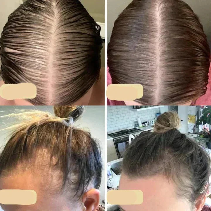Plant-Based Hair Growth Elixir | Nourish & Strengthen Naturally
