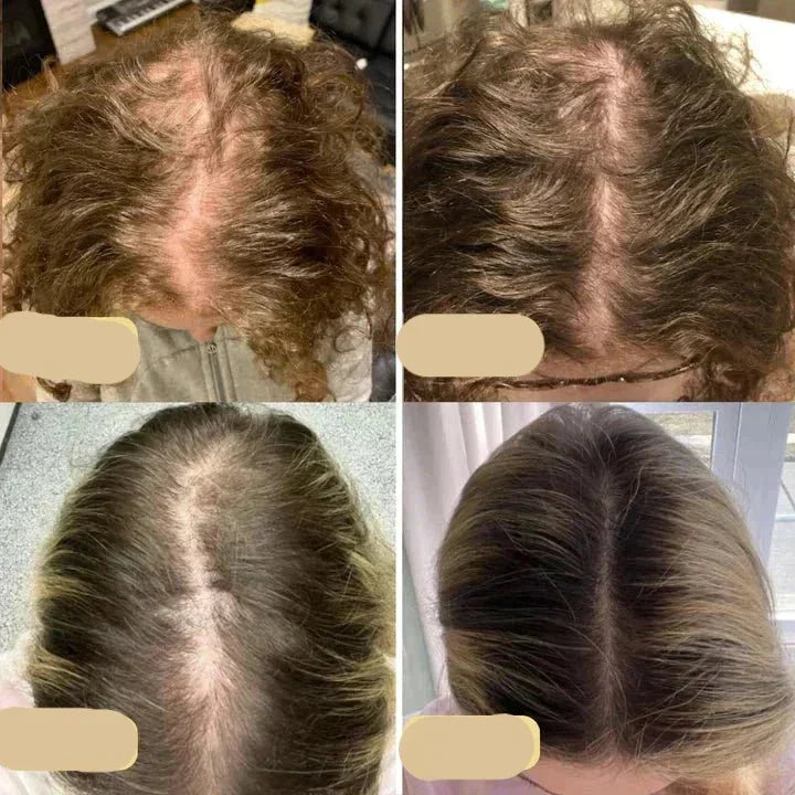Plant-Based Hair Growth Elixir | Nourish & Strengthen Naturally